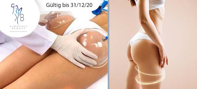 Po-Lifting mit Vakuumsystem