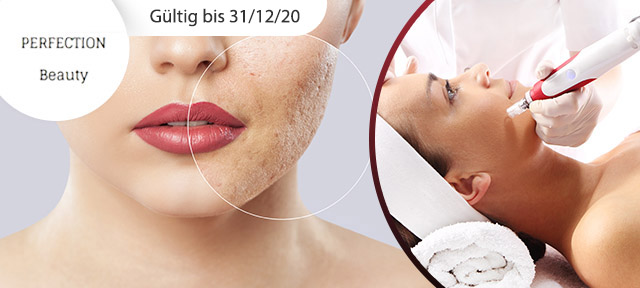 Microneedling