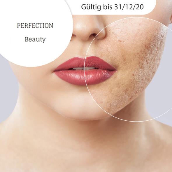 Microneedling