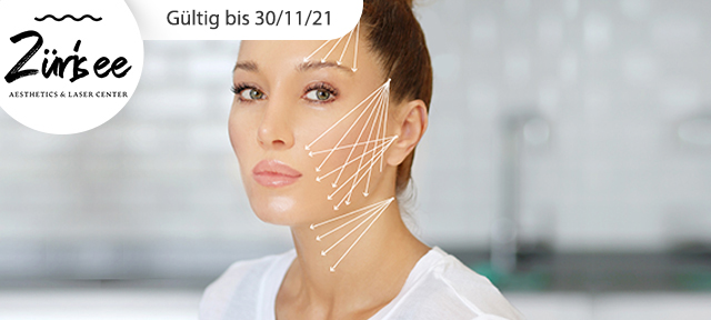 Fadenheftung - Silhouette Soft®