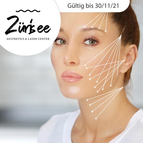 Fadenheftung - Silhouette Soft®