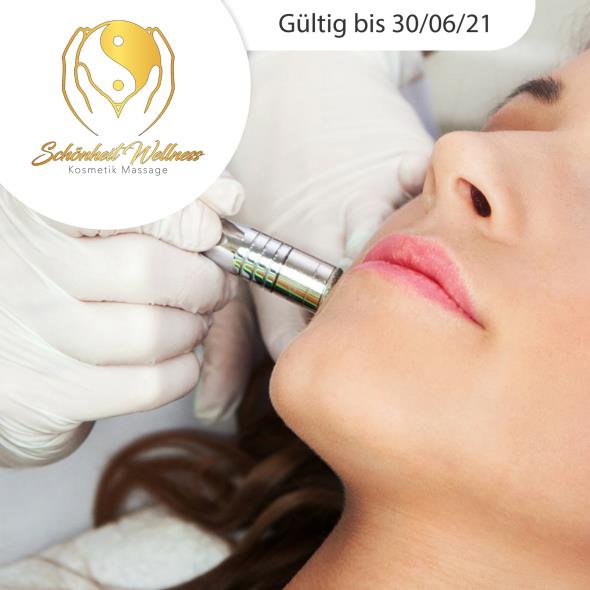 Diamant-Microdermabrasion