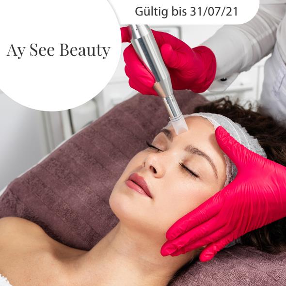 Microneedling