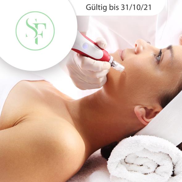 Radiofrequenz mit Microneedling