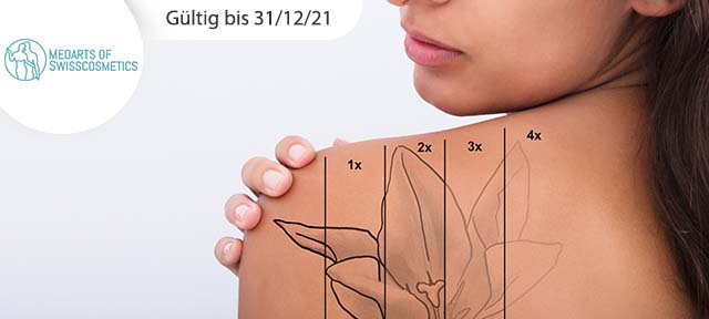 Wertgutschein für Tattooentfernung