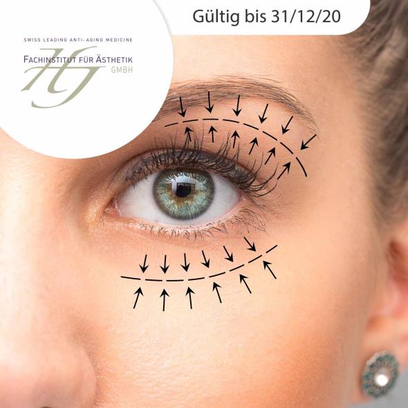 Microneedling