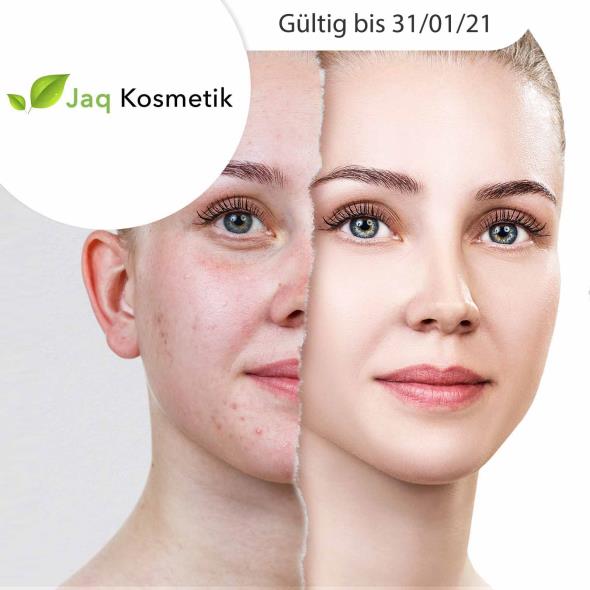 Faltenbehandlung mit Hyaluronpen
