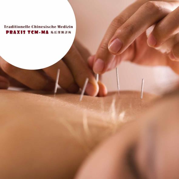 TCM-Behandlung
