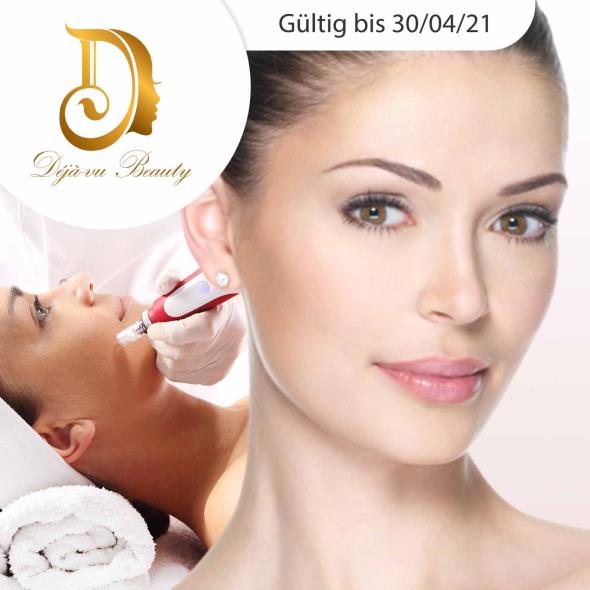 Microneedling
