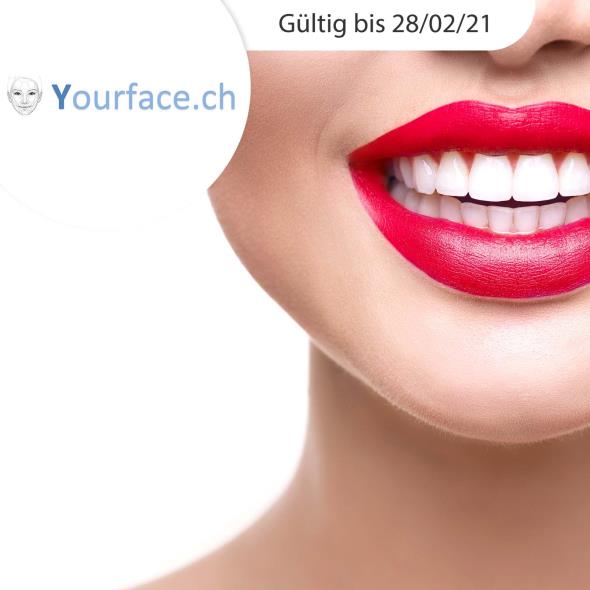 Powerbleaching