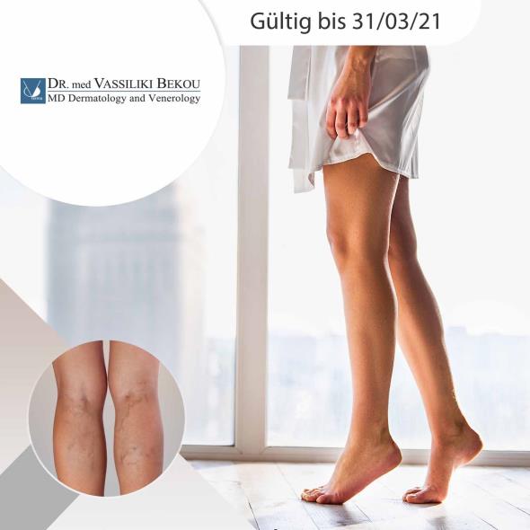 Besenreiserbehandlung mit Injektion