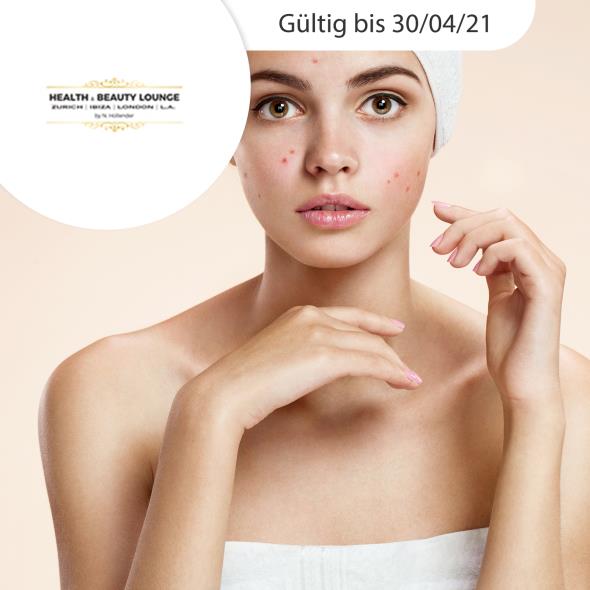 Akne-Behandlung mit Bestrahlung