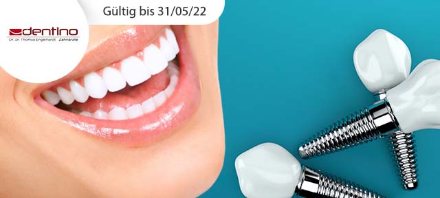 Keramikkronen und Implantate