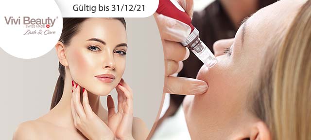 Microneedling