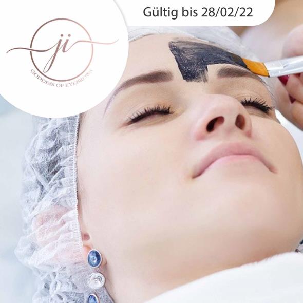 Carbon Laser Peel