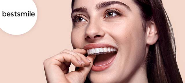 Zahnkorrektur mit Aligner oder Veneers