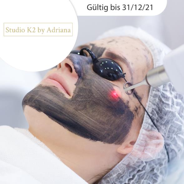 Carbon Laser Peeling