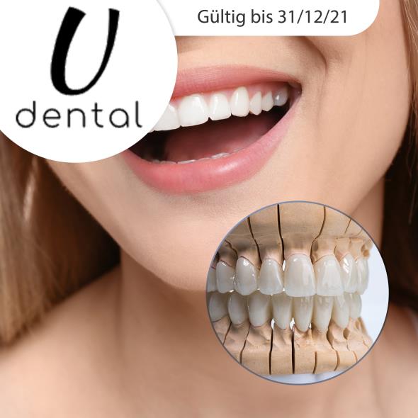 Hollywood Smile