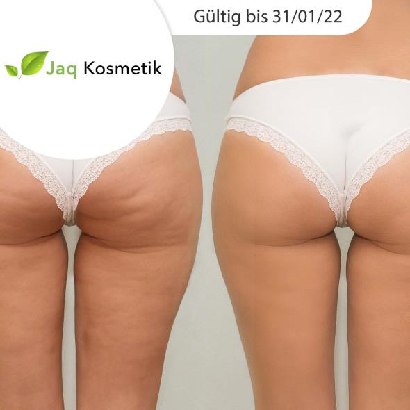Zur Traumfigur dank VelaShape®