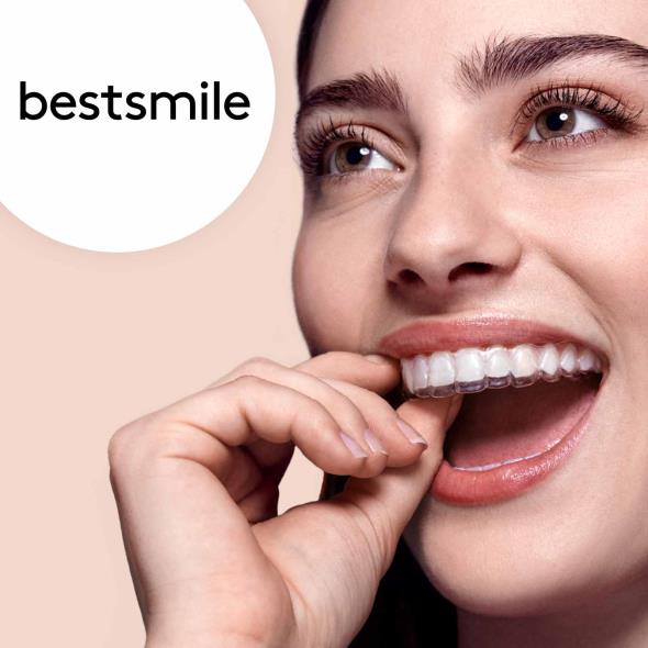 Zahnkorrektur mit Aligner oder Veneers